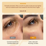 Under-Eye Puffiness & Dark Circle Balm