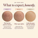 Breakout & Redness Repair Balm