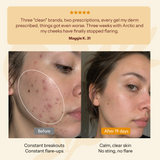 Breakout & Redness Repair Balm