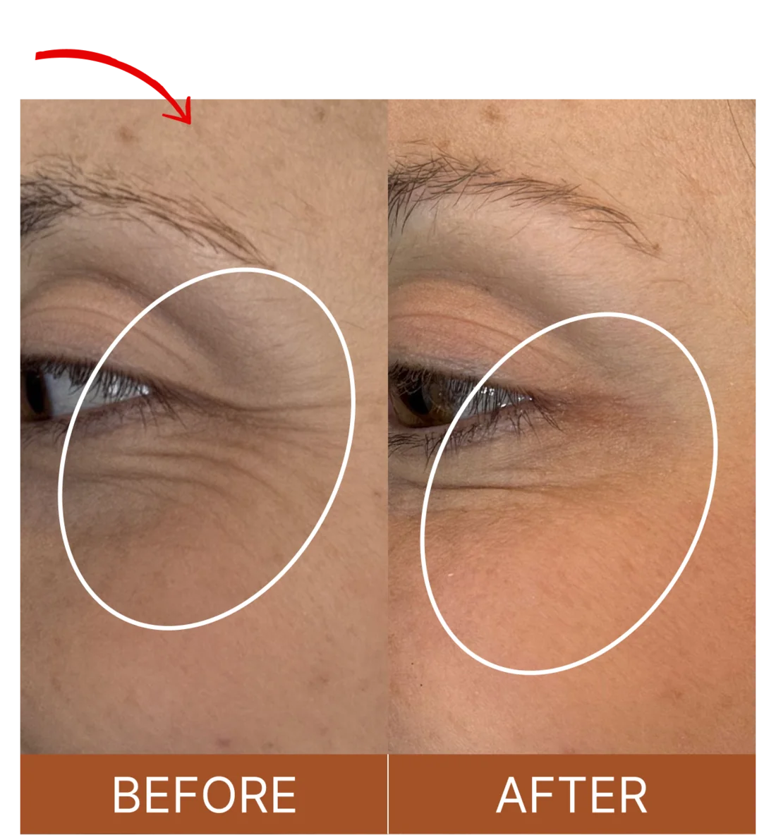 Susan, 45: eye-area wrinkles before and after using Arctic Organics